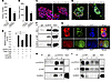 CLDN18 regulates AT2 cell proliferation and YAP activity, and CLDN18 and YA