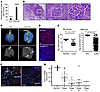 Increased tumor development in aged Cldn18–/– mice.