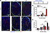 Anti–CTLA4 therapy increases vessel perfusion in a time-dependent manner be