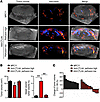 A global increase in tumor vessel perfusion on sonography on day 6 predicts