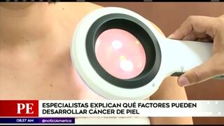 Salud: conoce los motivos que pueden desarrollar el cáncer de piel