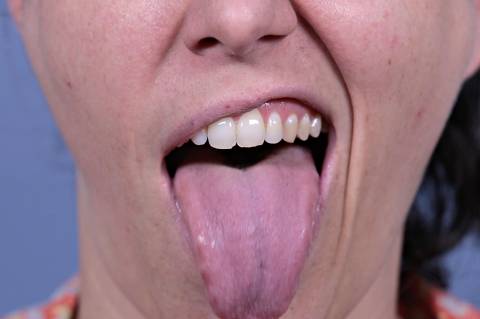 boca para o especial 'o tamanho da língua'