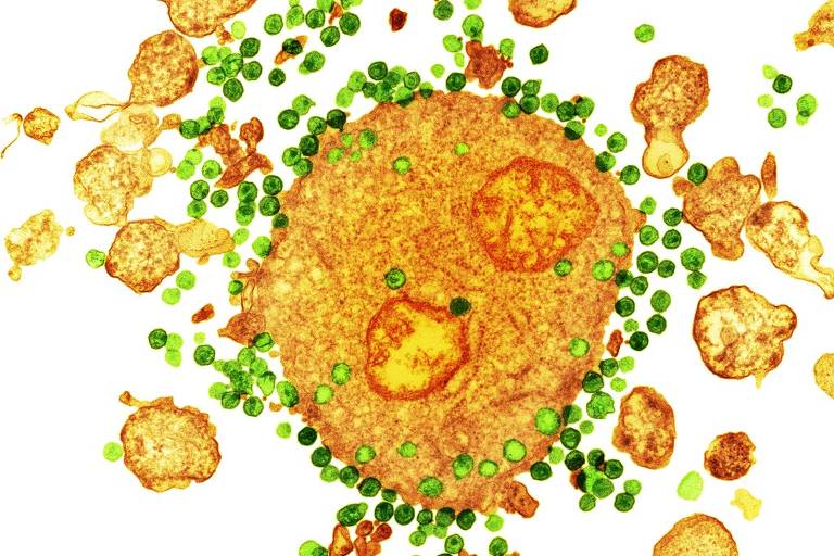 Imagem obtida com microscópio eletrônico mostra HIV, em verde, ligado a um glóbulo branco, em laranja