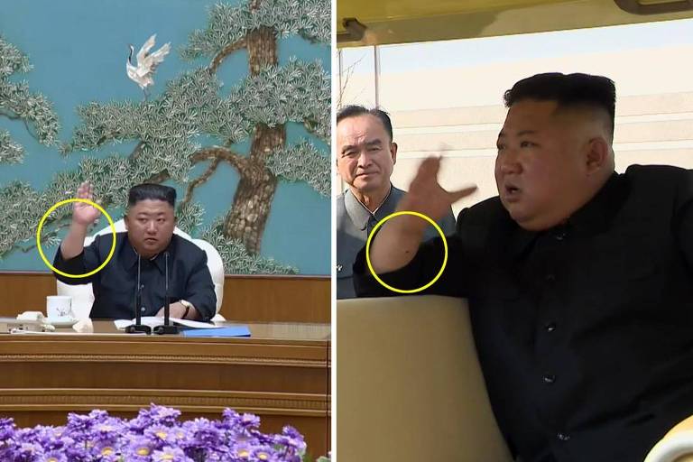 Montagem compara o punho de Kim Jon-un sem (esq.) e com marca (dir.); primeira foto é de 11 de abril e a segunda é desta sexta (1º)