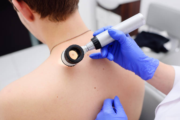 Dermatologista examina ferida pequena na pele