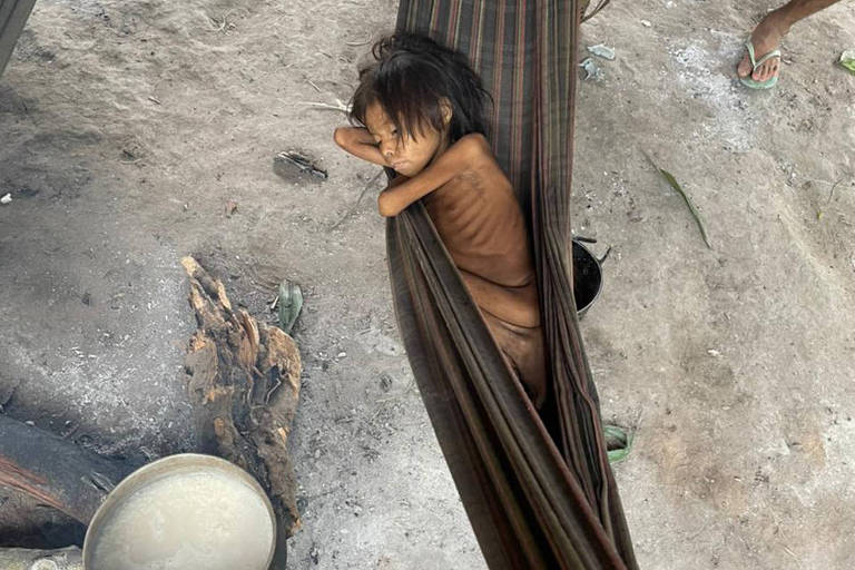 Criança magra ao ponto de ter ossos visíveis sob a pele, em rede