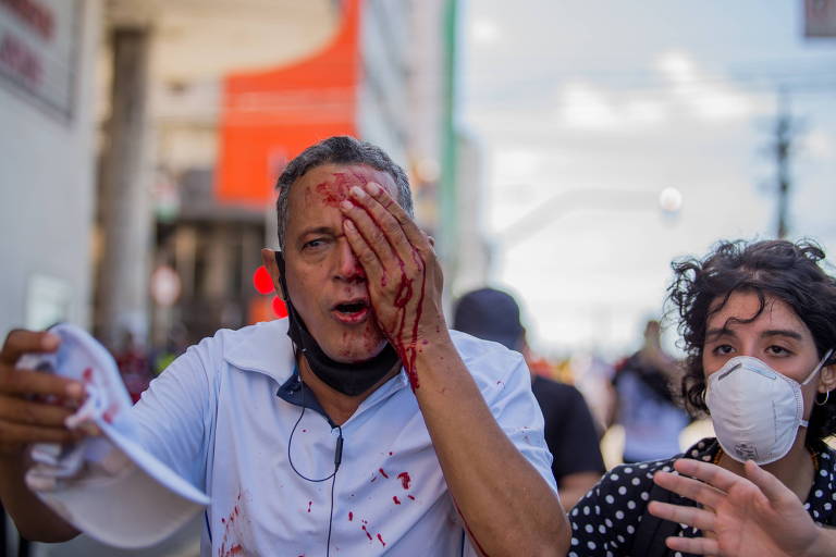 Daniel Campelo, 51, perdeu a visão de um olho após ser atingido por um tiro de bala de borracha durante as manifestações contra Bolsonaro no último sábado (29) no Recife
