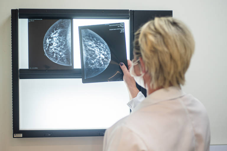Casos de câncer de mama crescem no mundo, e muitas mulheres continuam sem cuidado, diz comissão da Lancet