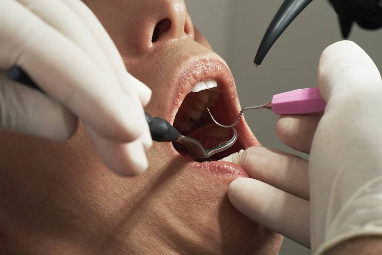 Procedimentos com planos de saúde odontológicos cresceram 6,8% em 2022, diz estudo