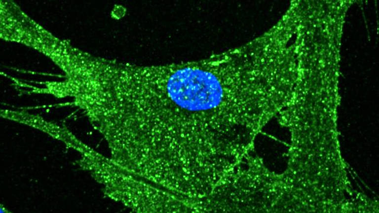 Imagem mostra desenho de célula semelhante a uma rede verde, com núcleo azul