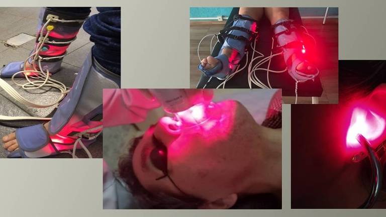 Aparelhos que combinam laser, ultrassom e pressão negativa ajudam a regenerar tecidos e tratar lesões musculares, articulares, neurológicas, dermatológicas e pulmonares