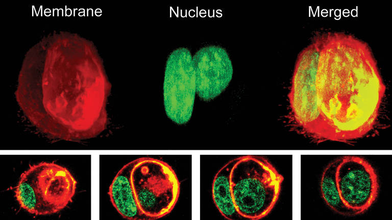 Projeção em 3D mostrando a membrana e o núcleo de uma célula tumoral separados e unidos. Abaixo, a projeção mostra cada fase até que esses pedaços se unem. 