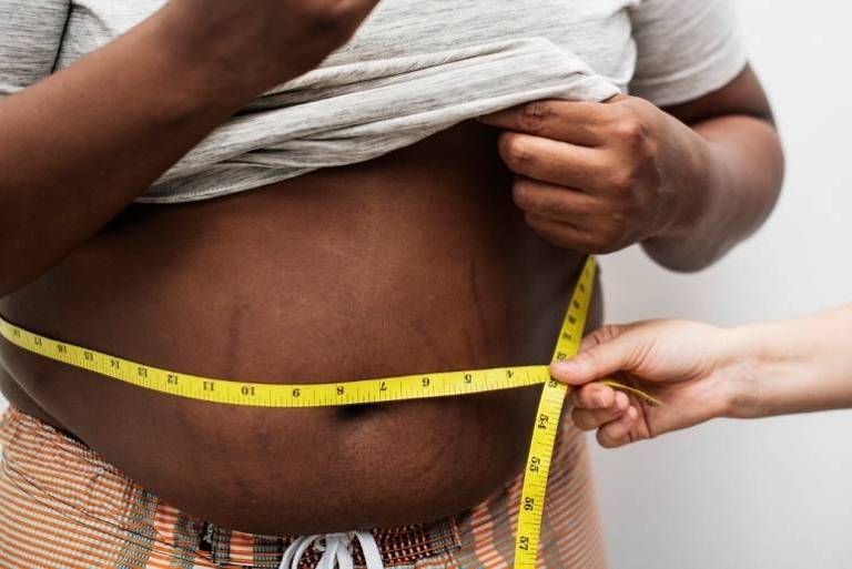 Quais os sintomas da obesidade e como diferenciá-la do sobrepeso? Tire suas dúvidas