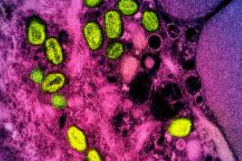 (FILES) This undated image obtained from the National Institute of Allergy and Infectious Diseases (NIAID) in Bethesda, Maryland, shows a colorized transmission electron micrograph of monkeypox particles (green) found within an infected cell (pink and purple), cultured in the laboratory. The World Health Organization on May 11, 2023, has declared that mpox no longer constitutes a global health emergency , almost exactly a year after the disease formerly known as monkeypox started spreading globally. WHO chief Tedros Adhanom Ghebreyesus said the decision was prompted by falling case numbers worldwide, but emphasised that the disease remains a threat, particularly in areas of Africa where it has long been present. (Photo by Handout / National Institute of Allergy and Infectious Diseases / AFP) / RESTRICTED TO EDITORIAL USE - MANDATORY CREDIT 