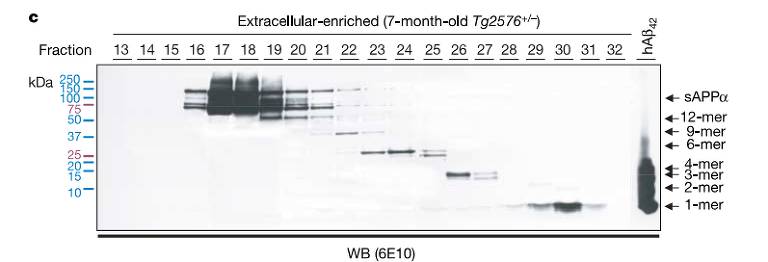 A imagem mostra um resultado típico de Western Blot, uma técnica de laboratório usada para detectar proteínas específicas em uma amostra. Há várias bandas escuras distribuídas horizontalmente ao longo do gel, indicando a presença de proteínas em diferentes pesos moleculares. 