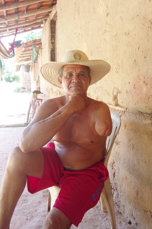 Sentado em uma cadeira de plástico junto a uma parede rústica, homem não tem o braço esquerdo e apoia o queixo com o punho direito. Ele veste apenas um calção vermelho e um chapéu de palha