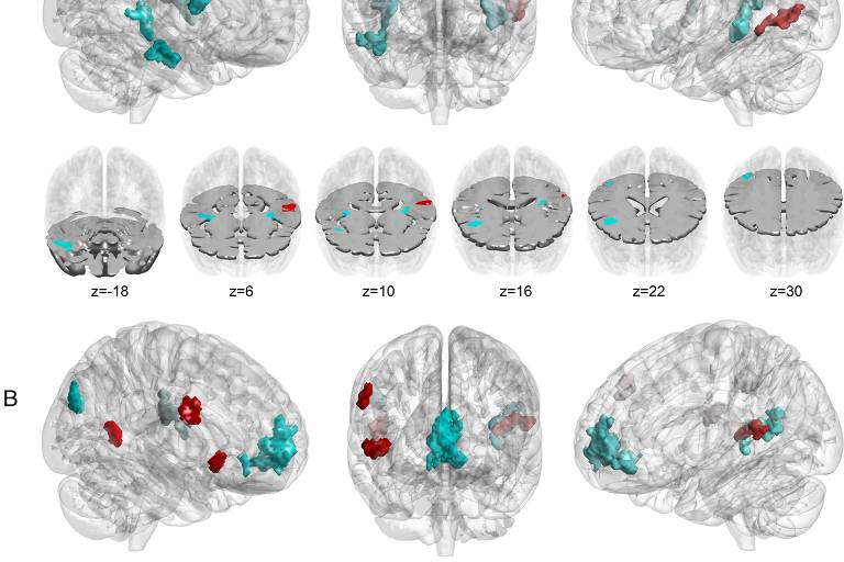 Estudo investiga como cérebro processa mudanças musicais e dá sentido a elas