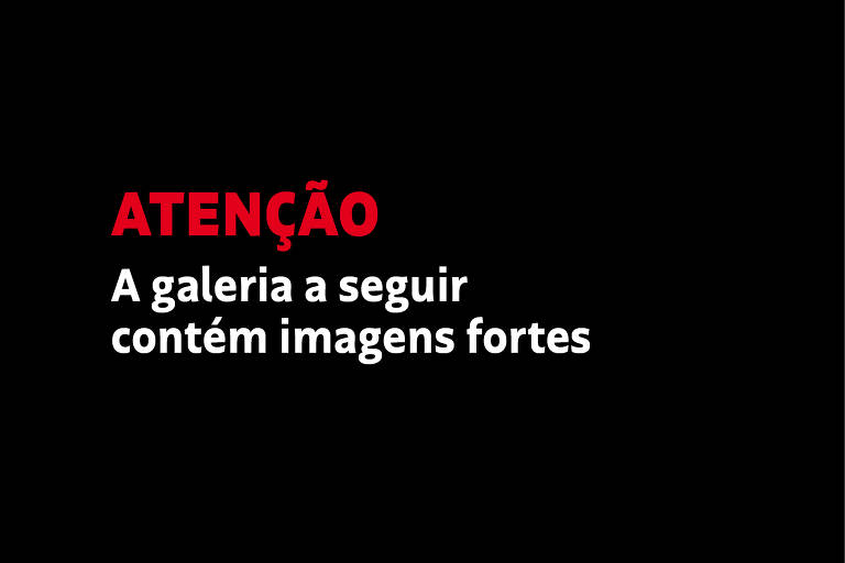 Atenção a galeria a seguir contem imagens fortes