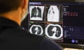 An NHS England staff member looks at the results of a lung scan