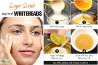 sugar scrub to remove whiteheads