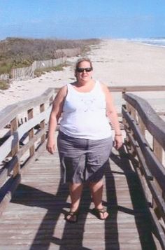 Gastric Bypass Sleeve Diet, Bariatric Before And After, Gastric Bypass Sleeve Before And After, Bariatric Sleeve Before And After, Bariatric Before And After Pictures, Sleeve Surgery Before And After, Gastric Bypass Before And After