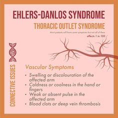 Thoracic Outlet