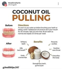 Oil Pulling Benefits, Remedies For Tooth Ache, Coconut Oil For Teeth, Whiter Teeth, Food Health Benefits, Benefits Of Coconut, Teeth Health, Coconut Oil Pulling, Benefits Of Coconut Oil