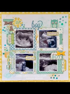 a scrapbook page with pictures of baby teeth