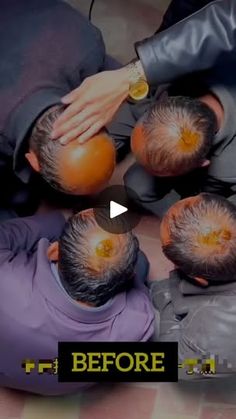 32K views · 2.6K reactions | Hair regrowth oil❣️ 
Follow @fashion_culture70 for more videos 

#skincare #haircare #beautytips #homeremedies #hairgrowth #hairfall #hairfallcontrol #hair #viral #instagram #reels | fashion_culture70