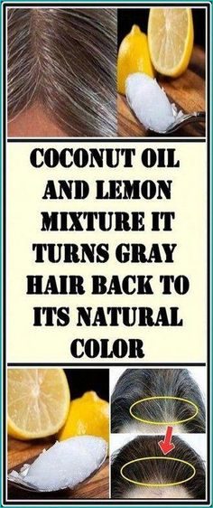 Hide Gray Hair, Prevent Gray Hair, Prevent Grey Hair, Reverse Gray Hair, Hair Dyes, Hair For Women, Natural Gray Hair, Regrow Hair, Nutritional Deficiencies