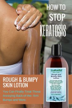 This formula smooths and softens your skin as it helps to gently, unclog pores to reveal bump free looking skin. This lotion is a long-lasting moisturizer that is easy to apply and quickly absorbed. Rough And Bumpy Skin, Just Nutritive, Patchy Skin, Acne Tips, Rough Bumpy Skin, How To Reduce Pimples, Natural Acne, Keratosis Pilaris