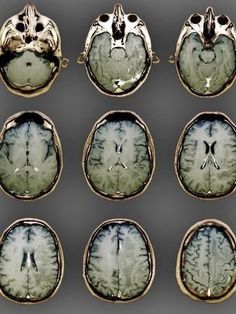 an image of the brain in different stages of development, from top left to bottom