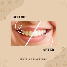 Show off your pearly whites! 😃✨ Smile Book, Kids Dentist, Whiten Your Teeth, Teeth Whitening System, Yellow Teeth, Best Teeth Whitening, Pediatric Dentistry, Natural Teeth Whitening