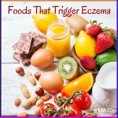 Can foods be triggering your or your child's eczema? YES they can! Learn more about food triggers and how to identify them! Varicose Vein Removal, Inflammatory Diet, Supper Recipes, Staying Healthy, Foods To Avoid, Evening Meals, Applique Patterns, Skin Conditions, Nutritious Meals