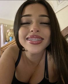 Lantinas Girl, Selfie Pretty Woman, Makeup With Braces, Pretty Girl Braces, Teeth Braces Aesthetic, Cute Braces Colors Aesthetic, Light Pink Braces, Pretty Latina Makeup