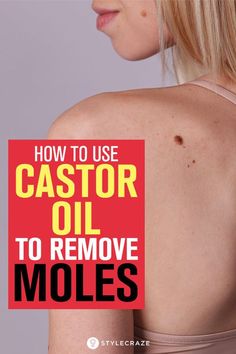 Moles On Face, Narrow Laundry, Remove Moles, Skin Growths, Beauty Tips For Skin