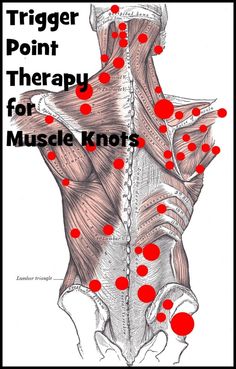 Muscle Knots, Trigger Point Therapy, Trigger Point, Shiatsu Massage, Massage Benefits, Joints Pain Relief