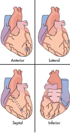 four different views of the human heart