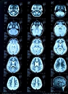 mri images show the different areas of the brain