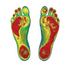 an image of the feet and toes of a person with different colored markings on them