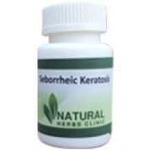 Natural Remedies for Seborrheic Keratosis | Natural Herbs Clinic Crusty Skin, High Blood Sugar Symptoms, Esential Oils, Homeopathy Remedies, Basal Cell, Oil Remedies