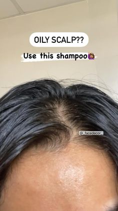 Prevent Oily Hair, Natural Hair Growth Remedies, Hair Growth Secrets, Hair Tips Video, Greasy Hair Hairstyles, Lost Hair, Hair Remedies