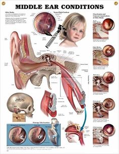 an image of medical diagrams showing the different types of ear conditions and how to use them