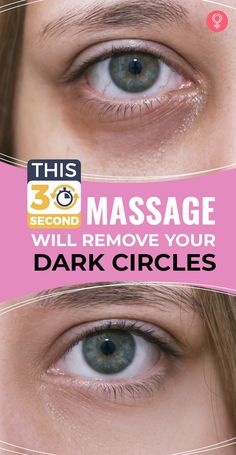 Eye Circle Remedies, Eye Massage, Under Eyes, Reduce Dark Circles