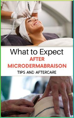 The Ultimate Guide to Microdermabrasion: Expectations and Pro Tips for Aftercare. Maximize the results of your microdermabrasion treatment with our expert advice and pro tips.💆‍♀️ #SkinCareJourney #GlowGetter #MicrodermMagic #SkinRenewal #BeautyTips #HealthySkin #SkinGoals #Microdermabrasion101 #BeautyRoutine #AftercareAdvice #SkincareTips #RadiantSkin Winter Skin Care, Cosmetic Treatments, Skin Care Mask, Diy Beauty Hacks, Improve Skin Texture, Skin Texture, Luxury Skincare, Aging Skin Care, Skin Rejuvenation