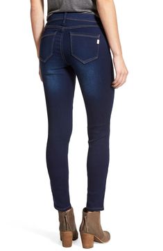 These soft jeggings with a low rise and clean, uncluttered styling are a pair you'll reach for again and again. 30" inseam; 10" leg opening; 8" front rise; 14" back rise (size 29) Zip fly with button closure Faux front pockets; back patch pockets 79% cotton, 20% polyester, 1% spandex Machine wash cold, tumble dry low Imported BP Oversized Turtleneck Sweater Dress, Cheap Leggings, Faux Suede Moto Jacket, Oversized Turtleneck, Embroidered Tee, Cozy Cardigan, Again And Again, Denim Leggings, Polished Look