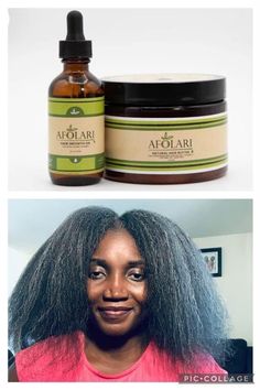 The bundle deal includes the hair growth butter and hair growth oil. Hair Butter Moisturizer Ingredients and Benefits: Coconut Oil - Stimulates hair growth by getting deep into its follicles. Coconut oil promotes the scalp health fighting against such problems as dandruff and lice. It moisturizes and adds shine to hair. Shea Butter - safe to use on damaged, dry, and colored hair. It contains essential nutrients that help to treat scalp conditions and improve the overall health of the scalp. This will, in turn, strengthen the hair follicles, reduce hair loss, and make your hair grow thicker. Jojoba Essential Oil - Moisturizes hair and protects against dryness, breakage, and split ends. Promotes hair growth and hair loss. Lavender Essential Oil - contributes to hair growth, natural fragrance Moisturizer Ingredients, Hair Butter, Boost Hair Growth, Hair Control, Scalp Health, Scalp Conditions, Hair Growth Faster, Hair Thickening, Stimulate Hair Growth