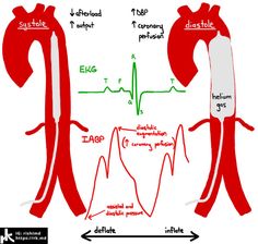 Cardiogenic Shock, Interventional Cardiology, Flight Nurse, Nursing Study Guide