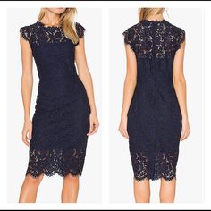 * Sleeveless * Fully Lined * Knee Length * Bodycon Dress * Zipper Back End * Cocktail Party Lace Dress * Soft And High Quality Fabric Bust Size Is: Small: 35.8 Inches Medium: 37.8 Inches Large: 40.1 Inches X-Large: 43.3 Inches New With Tags Knee-length Scalloped Lace Dress For Date Night, Scalloped Lace Knee-length Dress For Date Night, Sleeveless Lace Patchwork Dress For Night Out, Sleeveless Lace Patchwork Dress For Date Night, Sleeveless Lace Dress With Patchwork For Night Out, Sleeveless Lace Dress With Lace Patchwork For Night Out, Sleeveless Dress With Lace Patchwork For Date Night, Chic Blue Scalloped Lace Dress, Blue Chic Dress With Lace Patchwork