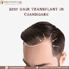 If you're looking for the best hair transplant in Chandigarh, look no further than Best Hair Transplant in Chandigarh. In this blog, we'll explore the reasons why Chandigarh Hair Transplant is the preferred choice for those in search of a life-changing transformation.